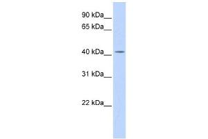 DHDDS antibody used at 1 ug/ml to detect target protein. (DHDDS antibody  (N-Term))