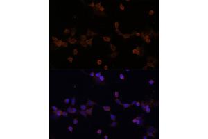 Immunofluorescence analysis of NIH-3T3 cells using UBE2L3 Polyclonal Antibody (ABIN1683196, ABIN3018653, ABIN3018655 and ABIN6220527) at dilution of 1:100 (40x lens). (UBE2L3 antibody  (AA 73-212))