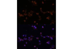 Immunofluorescence analysis of NIH-3T3 cells using UBE2L3 Polyclonal Antibody (ABIN1683196, ABIN3018653, ABIN3018655 and ABIN6220527) at dilution of 1:100 (40x lens).