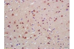 Formalin-fixed and paraffin embedded rat brain labeled with Anti-SATB2 Polyclonal Antibody, Unconjugated (ABIN1385735) at 1:200, followed by conjugation to the secondary antibody and DAB staining