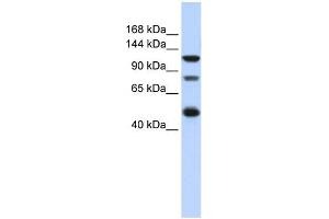 WB Suggested Anti-ZEB2 Antibody Titration:  0. (ZEB2 antibody  (Middle Region))