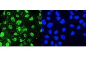 IF analysis of Hsp105 using anti-Hsp105 antibody (ABIN5693036).