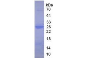 SDS-PAGE (SDS) image for Trypsin ELISA Kit (ABIN6574150)