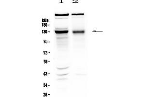 Western blot analysis of BMPR2 using anti-BMPR2 antibody . (BMPR2 antibody  (AA 455-512))