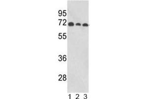 Western blot analysis of ABI1 antibody and human 1) MCF-7, 2) CEM, and 3) Jurkat lysate. (ABI1 antibody  (AA 81-108))