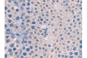 DAB staining on IHC-P; Samples: Mouse Testis Tissue (AASS antibody  (AA 477-926))