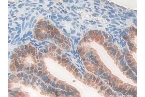 Immunohistochemistry (IHC) image for anti-Pyridoxal Kinase (PDXK) (AA 29-285) antibody (ABIN7441904)
