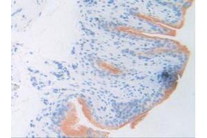 Figure. (ATF6 antibody  (AA 1-377))