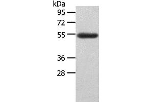 Western Blotting (WB) image for anti-Lymphocyte-Activation Gene 3 (LAG3) antibody (ABIN2431574) (LAG3 antibody)