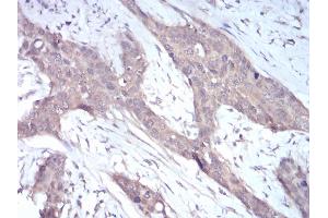 Immunohistochemistry (IHC) image for anti-NADPH Oxidase 4 (NOX4) (AA 210-310) antibody (ABIN5872374) (NADPH Oxidase 4 antibody  (AA 210-310))