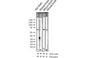Western blot analysis of Phospho-p62 Dok (Tyr398) expression in various lysates (DOK1 antibody  (pTyr398))