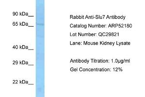 Western Blotting (WB) image for anti-SLU7 Splicing Factor Homolog (SLU7) (Middle Region) antibody (ABIN2774006) (SLU7 antibody  (Middle Region))