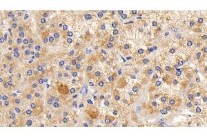 Detection of NFkB in Human Adrenal gland Tissue using Polyclonal Antibody to Nuclear Factor Kappa B (NFkB) (NFkB antibody  (AA 42-367))