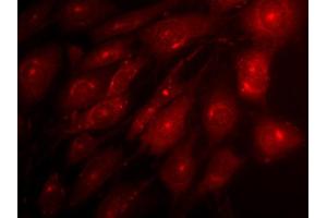 Indirect immunofluorescence on 3T3 cells (dilution 1 : 500) in combination with a Cy3 labeled secondary antibody (dilution 1 : 500). (Syntaxin 12/13 (AA 1-250) antibody)