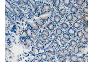 Detection of CASP8 in Mouse Colon Tissue using Polyclonal Antibody to Caspase 8 (CASP8) (Caspase 8 antibody  (AA 219-376))