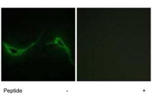 Immunofluorescence analysis of NIH/3T3 cells, using ADCY7 polyclonal antibody .