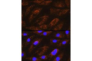 Immunofluorescence analysis of H9C2 cells using NDUF Rabbit pAb (ABIN6132401, ABIN6144467, ABIN6144468 and ABIN6215694) at dilution of 1:100 (40x lens). (NDUFA8 antibody  (AA 33-172))