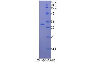 SDS-PAGE (SDS) image for Multimerin 1 (MMRN1) (AA 807-1053) protein (His tag) (ABIN2121650) (Multimerin 1 Protein (MMRN1) (AA 807-1053) (His tag))