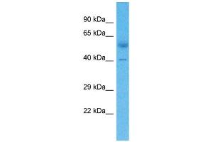 Host:  Rabbit  Target Name:  ZNF805  Sample Type:  Lung Tumor lysates  Antibody Dilution:  1. (ZNF805 antibody  (Middle Region))