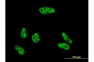 Immunofluorescence of monoclonal antibody to VPS72 on HeLa cell. (VPS72 antibody  (AA 1-364))