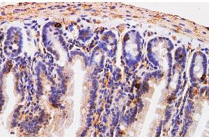 Immunohistochemistry (Paraffin-embedded Sections) (IHC (p)) image for anti-Chromogranin A (CHGA) antibody (ABIN7234264)