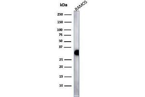 Western Blotting (WB) image for anti-MHC Class II HLA-DP/DQ/DR (HLA-DP/DQ/DR) antibody (ABIN6941452)