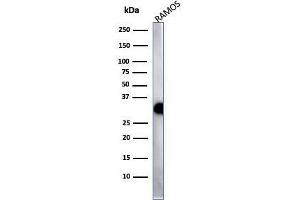 Western Blot Analysis of Ramos cell lysate using HLA-Pan Recombinant Rabbit Monoclonal Antibody (HLA-Pan/2967R). (Recombinant MHC Class II HLA-DP/DQ/DR antibody)