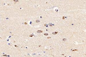 Immunohistochemistry analysis of paraffin-embedded human brain using,PSMD8 (ABIN7075226) at dilution of 1: 2600 (PSMD8 antibody)