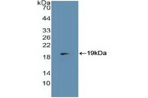 Detection of Recombinant MCP, Human using Polyclonal Antibody to Membrane Cofactor Protein (MCP) (CD46 antibody  (AA 147-285))