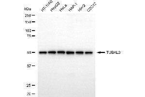 anti-Tubulin, alpha-Like 3 (TUBAL3) antibody