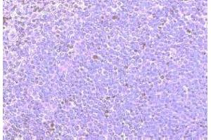 Immunohistochemistry on paraffin section of human spleen (CCRD6 (Extracellular Domain), (N-Term) antibody)