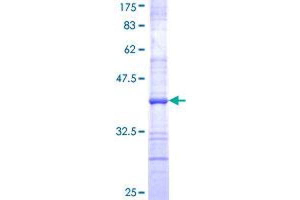 TNFAIP2 Protein (AA 552-650) (GST tag)