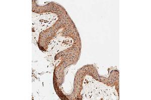 Immunohistochemical analysis of paraffin-embedded human skin tissue using C performed on the Leica® BOND RXm. (ALOXE3 antibody  (AA 223-252))