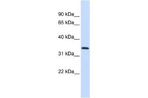 WB Suggested Anti-ANXA4 Antibody Titration:  0. (Annexin IV antibody  (Middle Region))