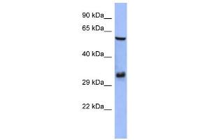 WB Suggested Anti-FOSL1 Antibody Titration:  0. (FOSL1 antibody  (Middle Region))