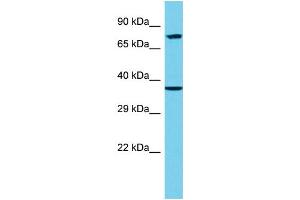 Host: Rabbit Target Name: EPN3 Sample Type: 293T Whole Cell lysates Antibody Dilution: 1. (EPN3 antibody  (C-Term))