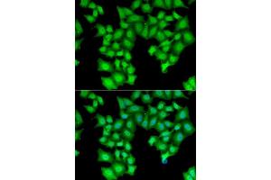 Immunofluorescence analysis of HeLa cells using CPSF3L antibody. (CPSF3L antibody  (AA 331-600))