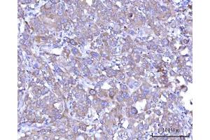 IHC analysis of RPS25 using anti-RPS25 antibody (ABIN7601567). (RPS25 antibody  (AA 39-125))