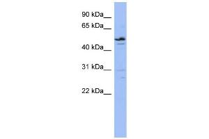WB Suggested Anti-ZNF419 Antibody Titration:  0. (ZNF419 antibody  (N-Term))