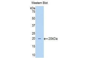 Western Blotting (WB) image for anti-Hexosaminidase B (Beta Polypeptide) (HEXB) (AA 294-435) antibody (ABIN3208192) (HEXB antibody  (AA 294-435))