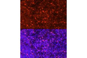 Immunofluorescence (IF) image for anti-Lymphoid Enhancer-Binding Factor 1 (LEF1) (AA 100-399) antibody (ABIN1680678)