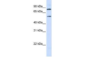 Western Blotting (WB) image for anti-Solute Carrier Family 27 (Fatty Acid Transporter), Member 4 (SLC27A4) antibody (ABIN2458790) (SLC27A4 antibody)