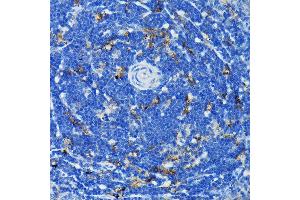 Immunohistochemistry (IHC) image for anti-Tumor Necrosis Factor Receptor Superfamily, Member 1A (TNFRSF1A) (AA 22-211) antibody (ABIN1513619)