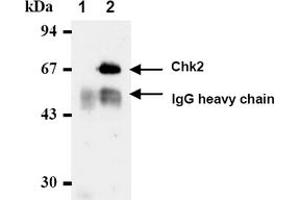 Western Blotting (WB) image for anti-Checkpoint Kinase 2 (CHEK2) antibody (ABIN487312) (CHEK2 antibody)