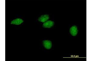 Immunofluorescence of purified MaxPab antibody to FLJ35220 on HeLa cell. (Endonuclease V antibody  (AA 1-264))