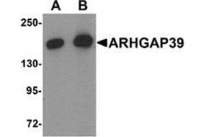 Western blot analysis of ARHGAP39 in A20 cell lysate with ARHGAP39 Antibody  at (A) 1 and (B) 2 μg/ml. (ARHGAP39 antibody  (C-Term))