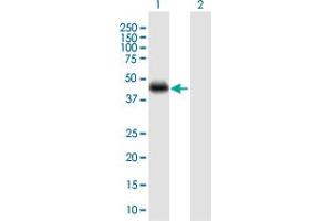 Western Blot analysis of CRELD1 expression in transfected 293T cell line by CRELD1 MaxPab polyclonal antibody. (CRELD1 antibody  (AA 1-422))