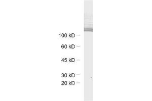 dilution: 1 : 1000, sample: mouse retina extract (Ribeye (AA 95-207) antibody)