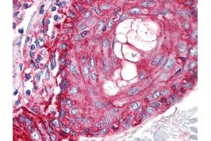 Immunohistochemistry staining of human skin (paraffin sections) using anti-CD59 (MEM-43/5). (CD59 antibody)