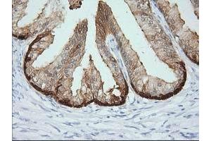 Immunohistochemical staining of paraffin-embedded Human prostate tissue using anti-CRYM mouse monoclonal antibody. (CRYM antibody)